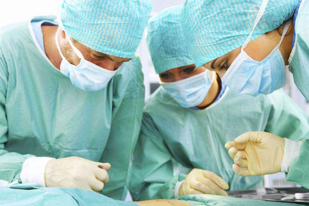 Penis enlargement surgery and its cost photo 3